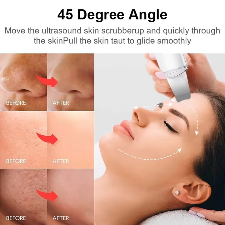 SkinSonic™ – Ultraschall-Skin-Scrubber, Tiefenreinigung & strahlende, gesunde Haut [50% Rabatt]