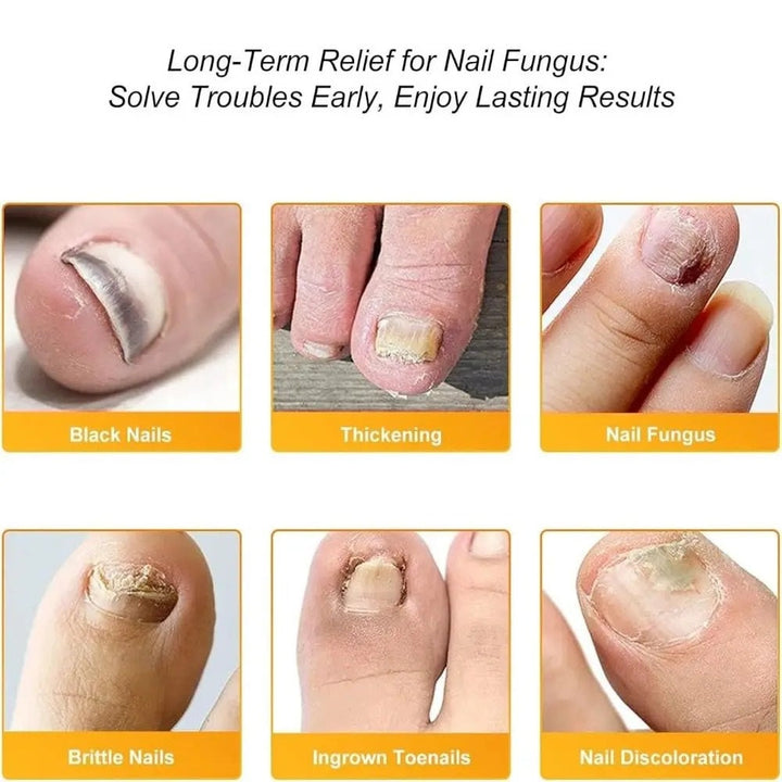 FungalPatch™ – Antibakterieller, schimmelhemmender Patch für effektive Nagelpflege [50% Rabatt]