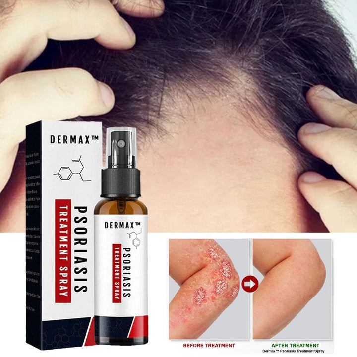 Dermax™ – Effektives Schuppenflechte-Spray für schnelle Hautlinderung [1 + 1 Gratis]