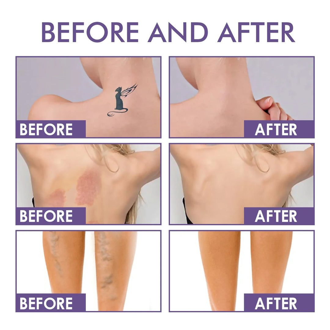 Silhouetta™ – Shaping Body Perfector für eine glattere Körperform