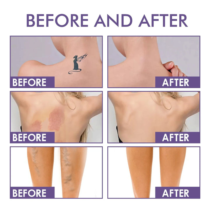 Silhouetta™ – Shaping Body Perfector für eine glattere Körperform