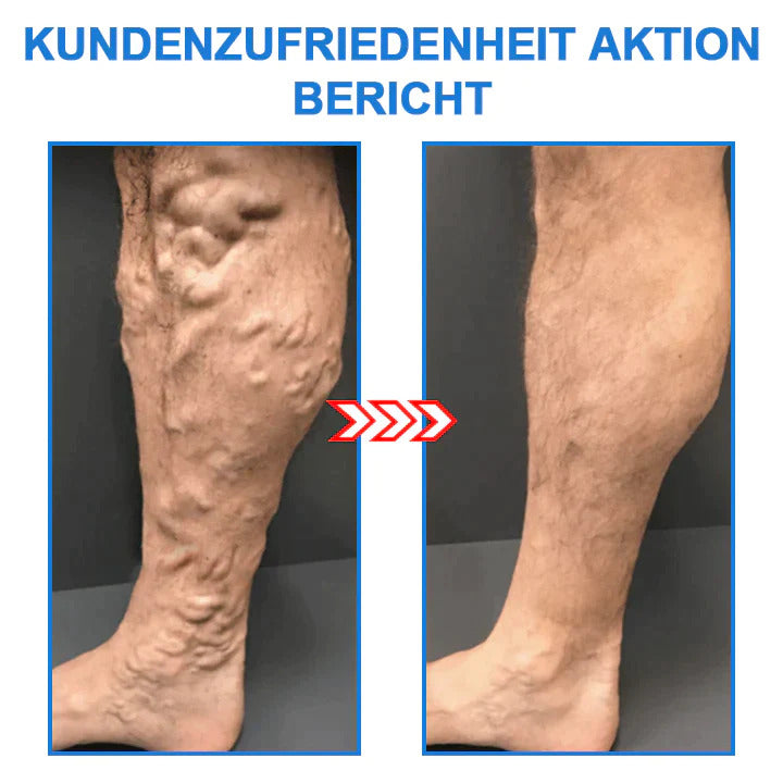 (1+2 Gratis) SlimmingSocks™ Schlanke Beine und straffe Haut in einem Schritt!