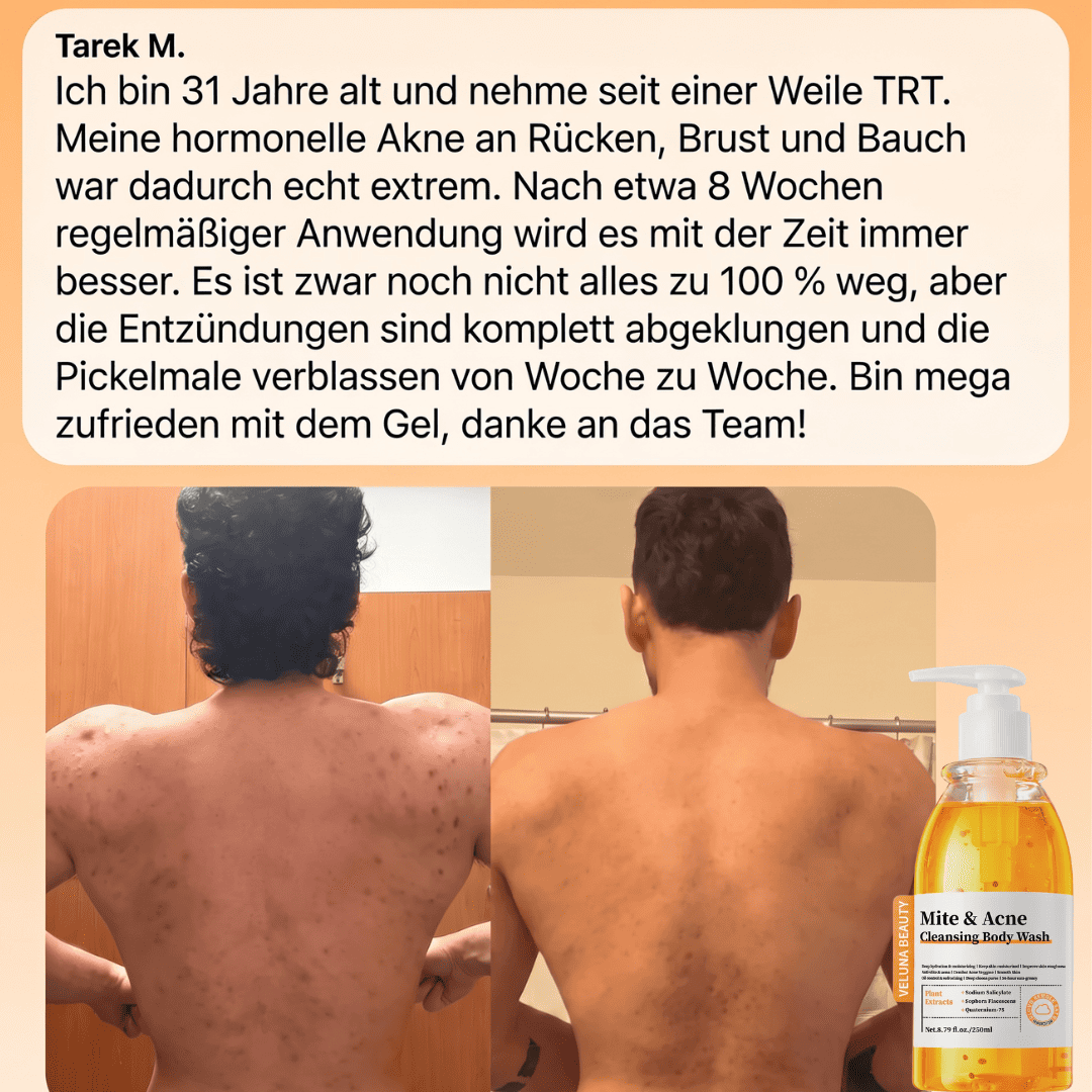 HautKlar™ Körperwaschgel gegen Unreinheiten
