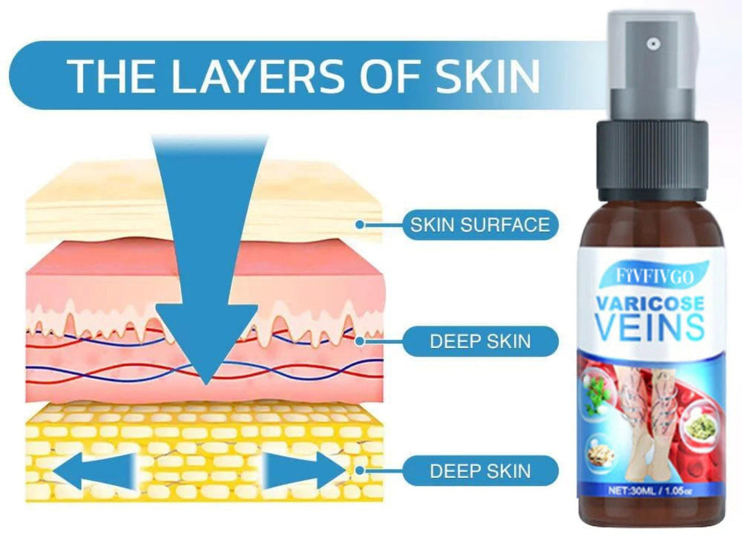 VariCose™ – Effektives Krampfader-Spray für schnelle Linderung und gesunde Beine [1 + 1 Gratis]
