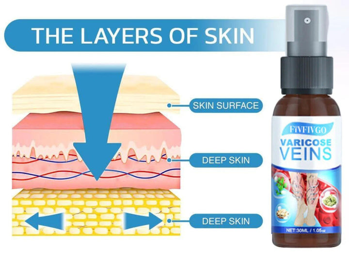 VariCose™ – Effektives Krampfader-Spray für schnelle Linderung und gesunde Beine [1 + 1 Gratis]