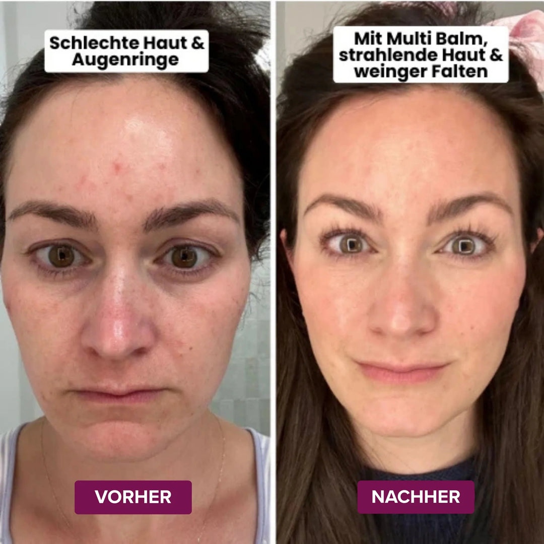 Calcium-Multi-Balsam für straffere, strahlendere Haut im Alltag