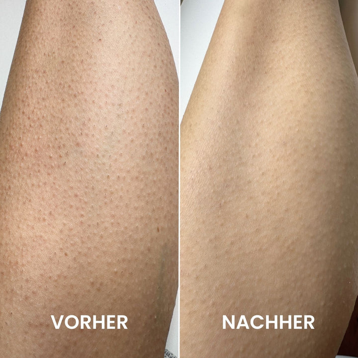 HautGlanz™ Peeling-Komplettset