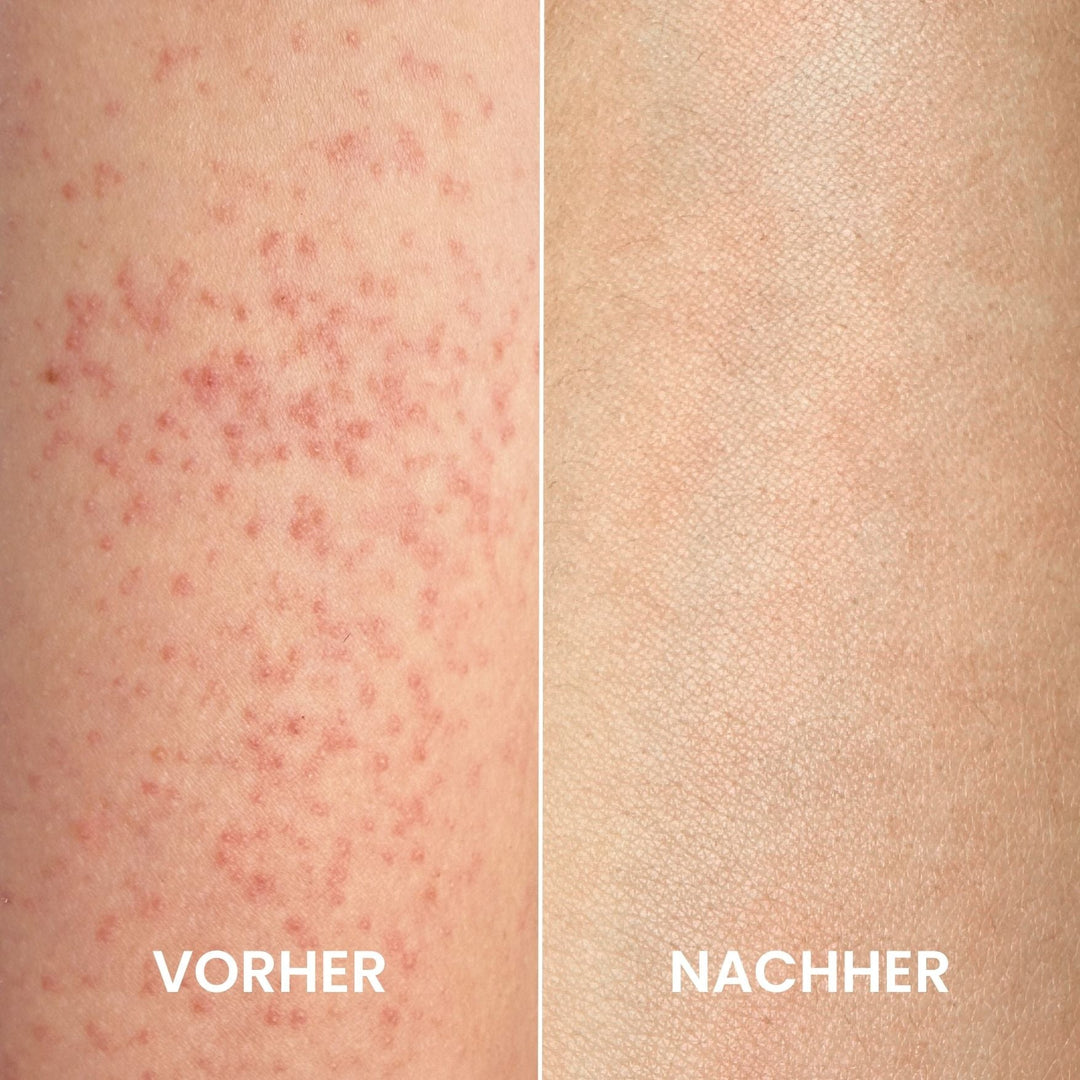 HautGlanz™ Peeling-Komplettset