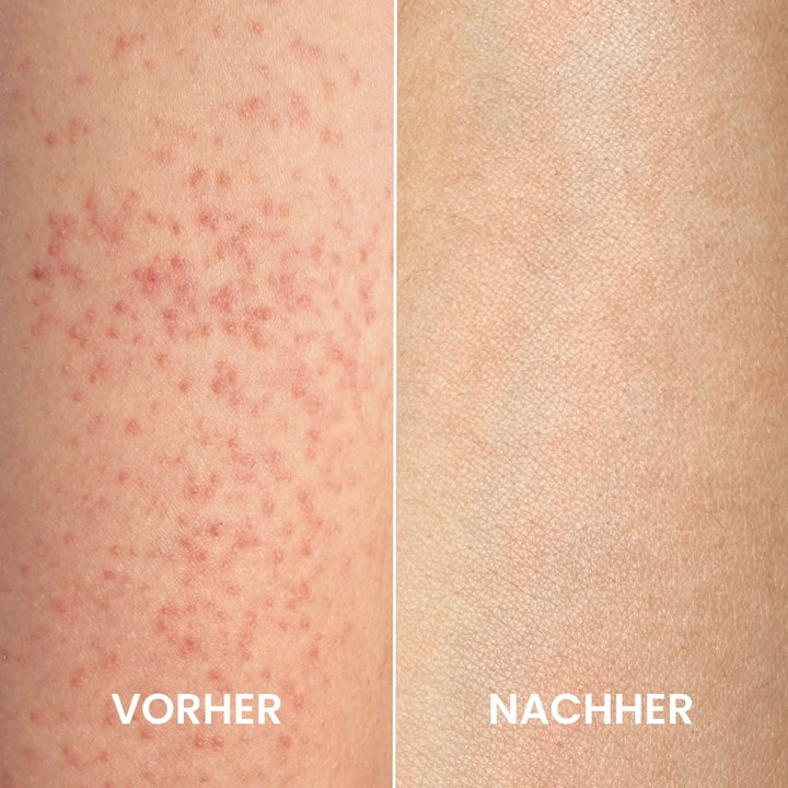 HautGlanz™ Peeling-Komplettset