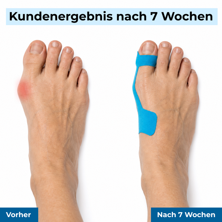 ZehenSanft™ Hallux-Valgus-Korrekturbandage