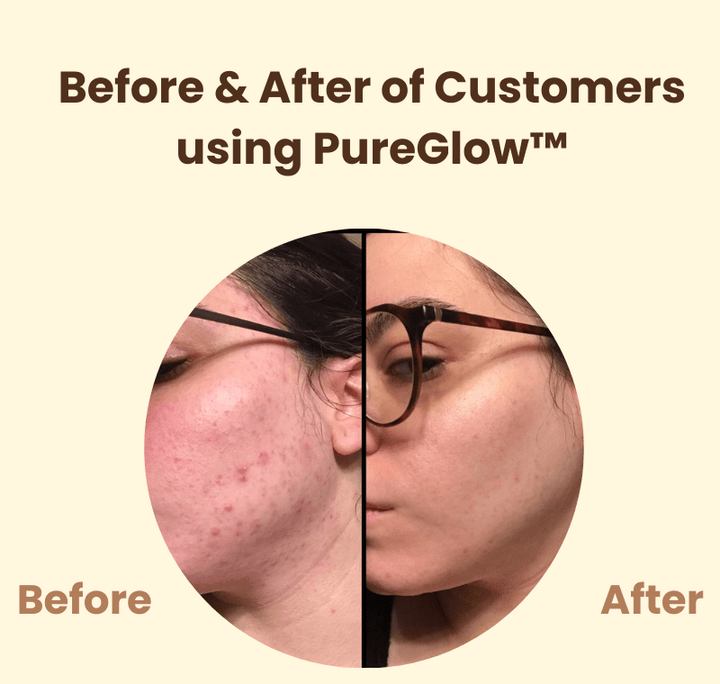 PureGlow™ – Natürliche Ausstrahlung & neues, strahlendes Selbstvertrauen [50% Rabatt]