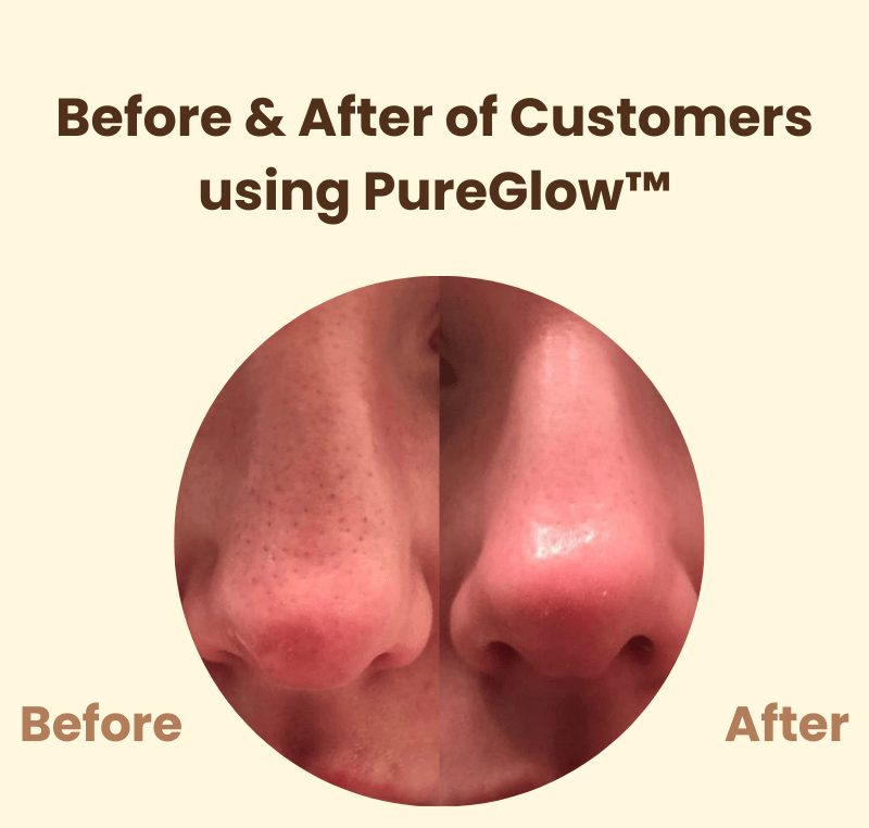PureGlow™ – Natürliche Ausstrahlung & neues, strahlendes Selbstvertrauen [50% Rabatt]