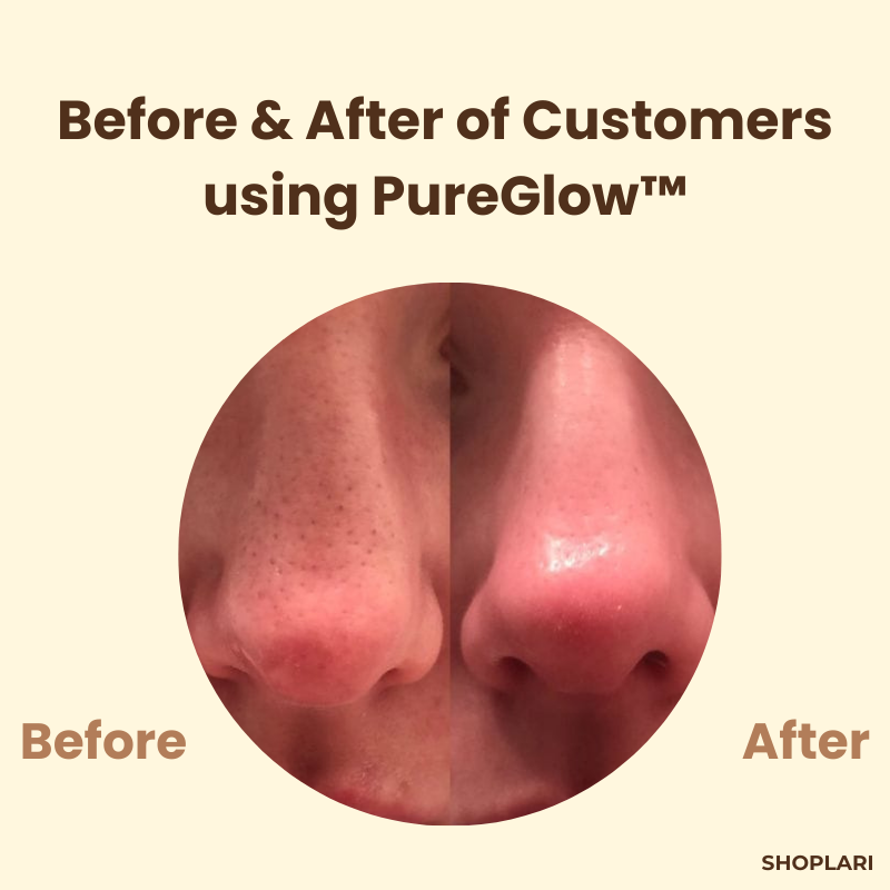 PureGlow™ – Schwarzer Tee & Ginseng gegen Akne, Falten & Hautunreinheiten für strahlende Haut [1 + 1 Gratis]