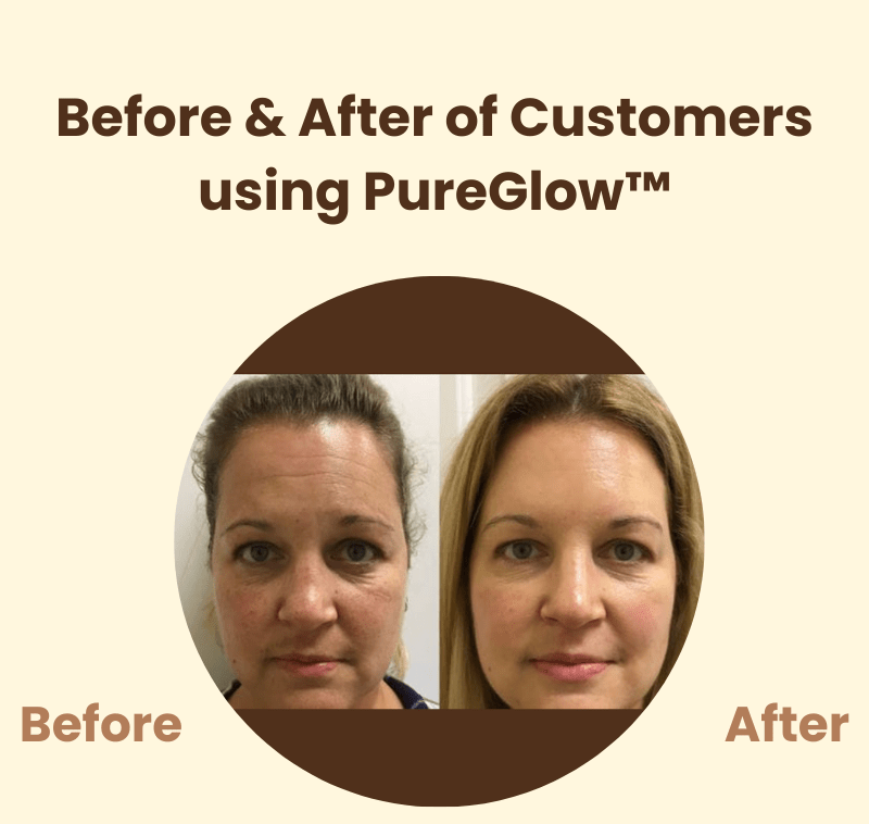 PureGlow™ – Natürliche Ausstrahlung & neues, strahlendes Selbstvertrauen [50% Rabatt]