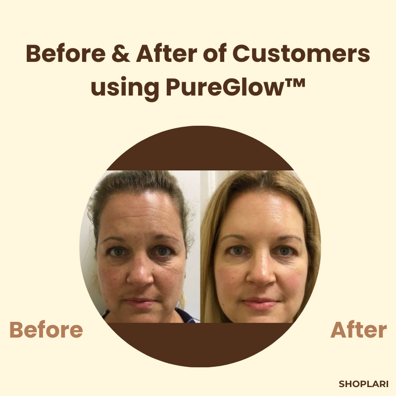 PureGlow™ – Schwarzer Tee & Ginseng gegen Akne, Falten & Hautunreinheiten für strahlende Haut [1 + 1 Gratis]