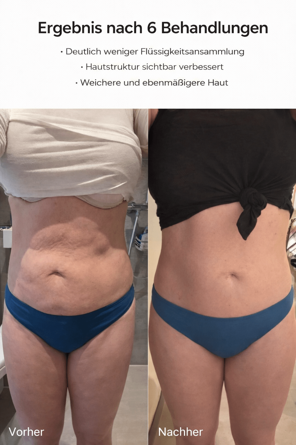 HautGlatt™ Körperpflege gegen Cellulite