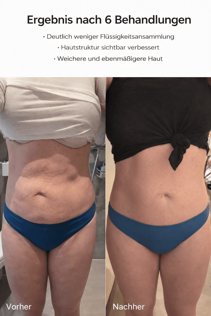 HautGlatt™ Körperpflege gegen Cellulite