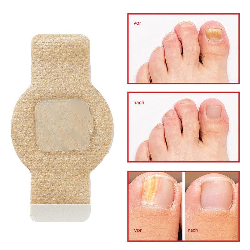 Nailox™ – Für klare, gesunde Nägel mit diskreter Pflege den ganzen Tag lang [1 + 1 Gratis]
