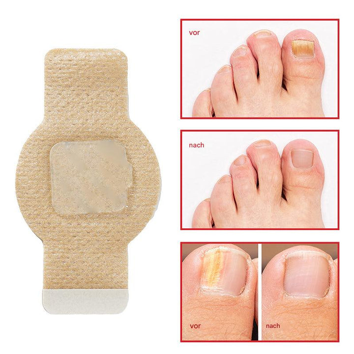 Nailox™ – Für klare, gesunde Nägel mit diskreter Pflege den ganzen Tag lang [1 + 1 Gratis]