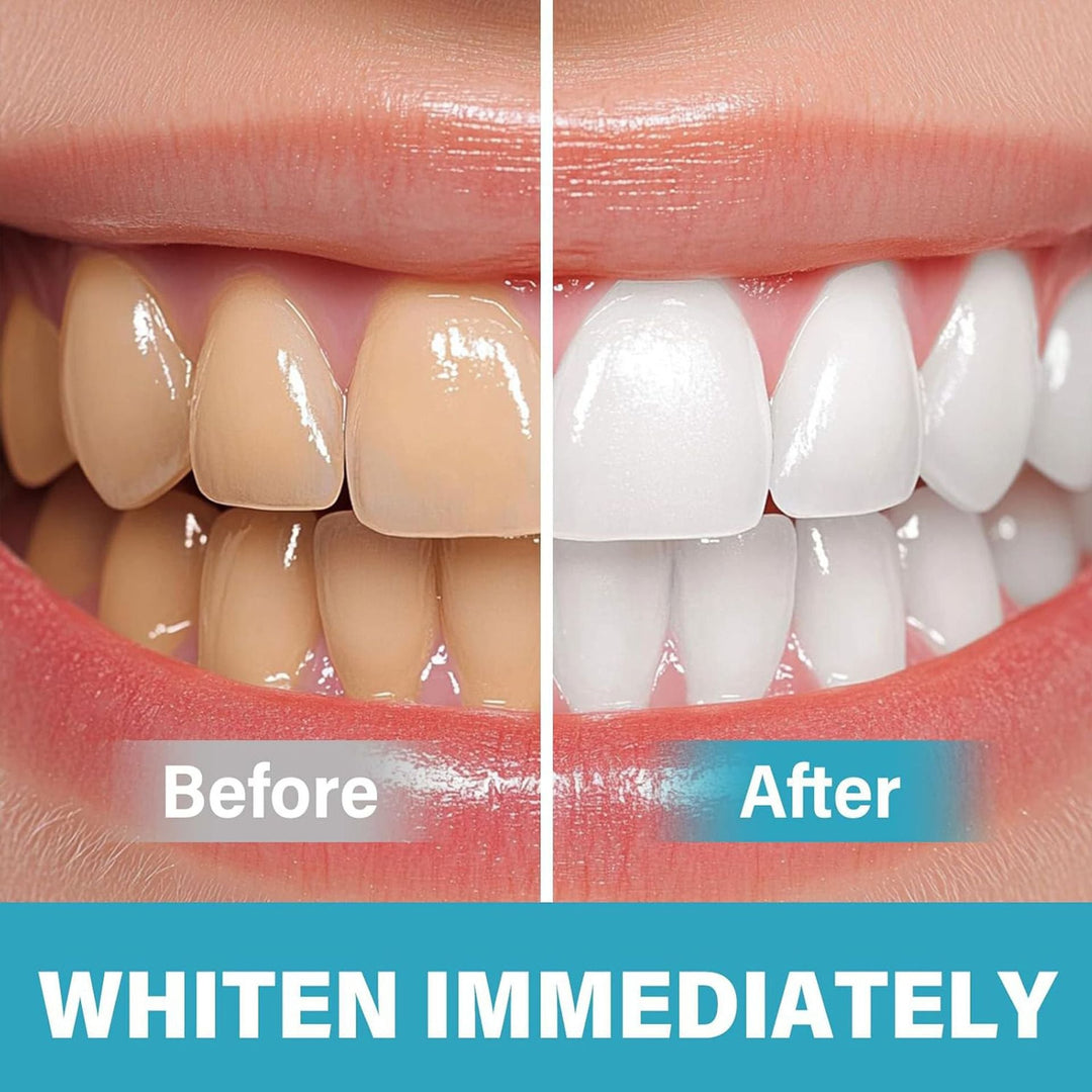 BrightSmile™ – Sofortiges Zahnaufhellungs-Pigment für ein strahlendes Lächeln [1 + 1 Gratis]