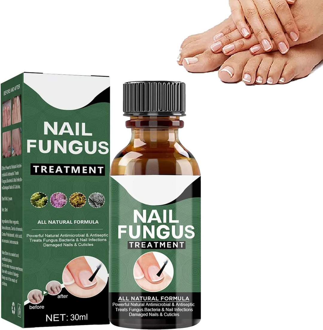 PureNail™ – Nagelpilz-Reparaturserum, heilt, restauriert & schützt beschädigte Nägel effektiv [50% Rabatt]