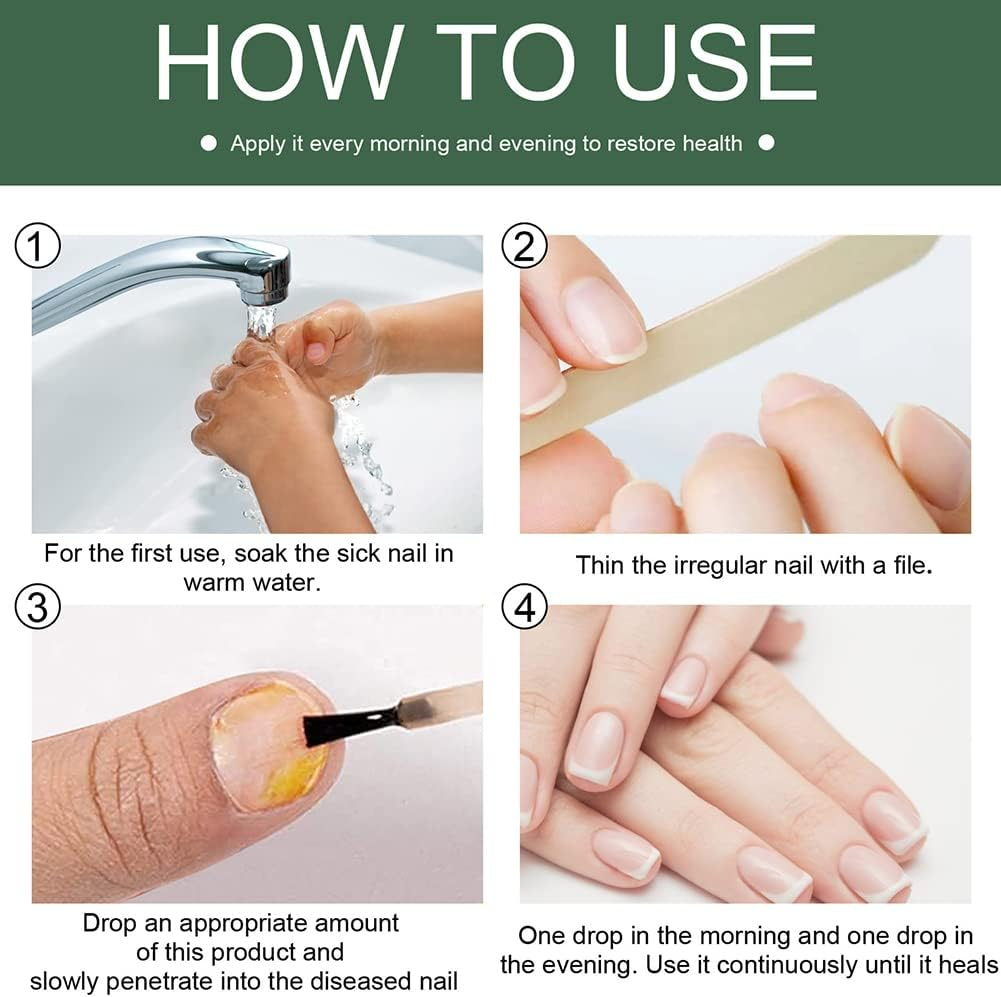 PureNail™ – Nagelpilz-Reparaturserum, heilt, restauriert & schützt beschädigte Nägel effektiv [1 + 1 Gratis]