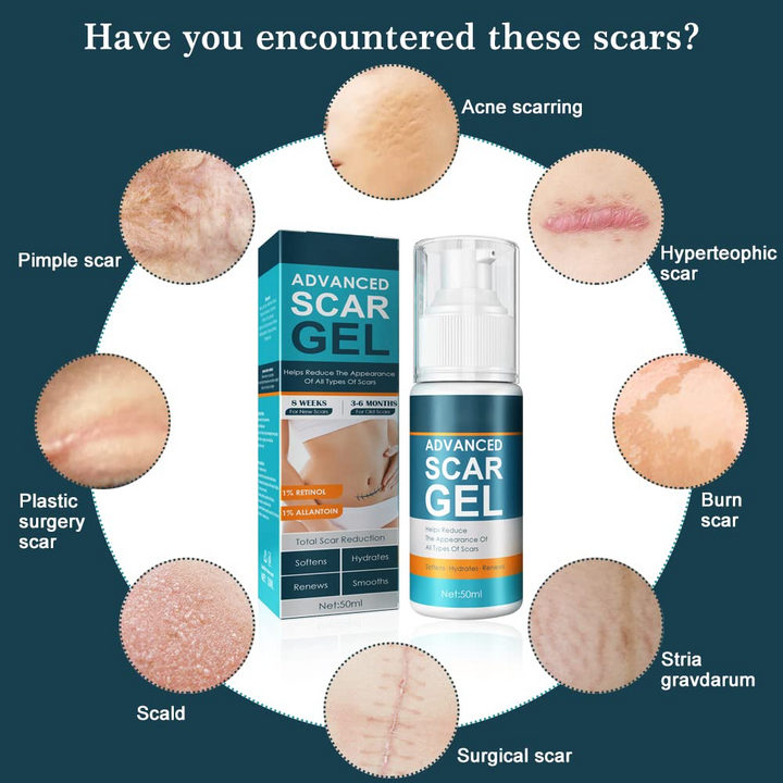 ScarRelief™ – Beruhigen, Heilen und Haut sichtbar sanft regenerieren und erneuern [1 + 1 Gratis]