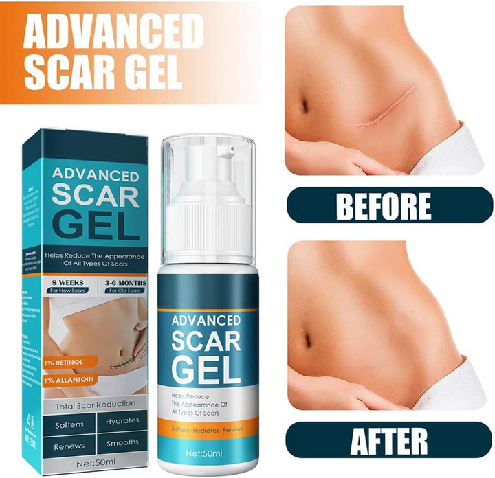 ScarRelief™ – Beruhigen, Heilen und Haut sichtbar sanft regenerieren und erneuern [1 + 1 Gratis]