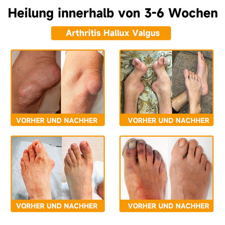 1+1 GRATIS | BeeLixir™ | Bienengiftcreme | Salbe mit Bienengift, Hyaluron & Kollagen