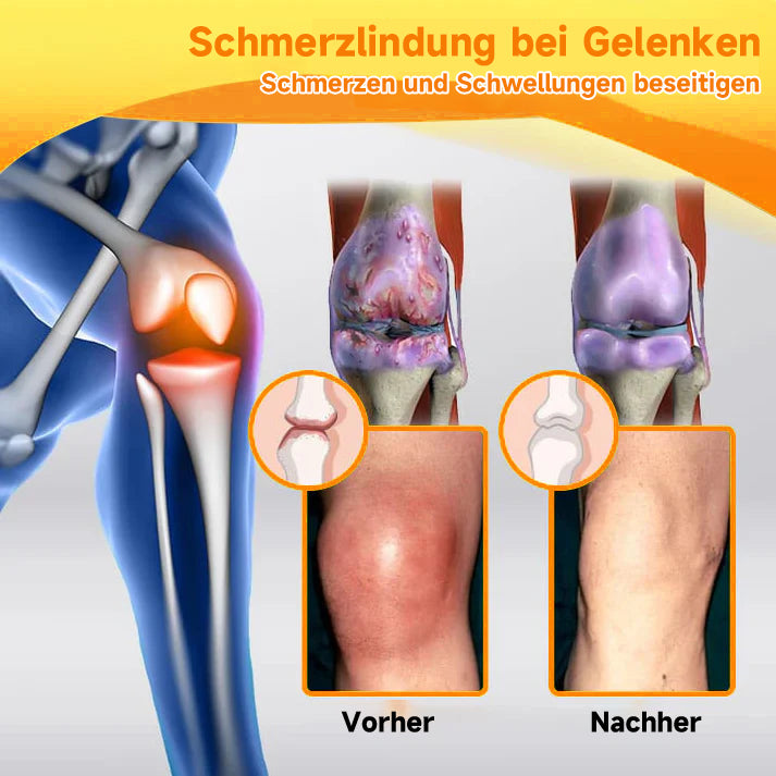 1+1 GRATIS | BeeLixir™ | Bienengiftcreme | Salbe mit Bienengift, Hyaluron & Kollagen