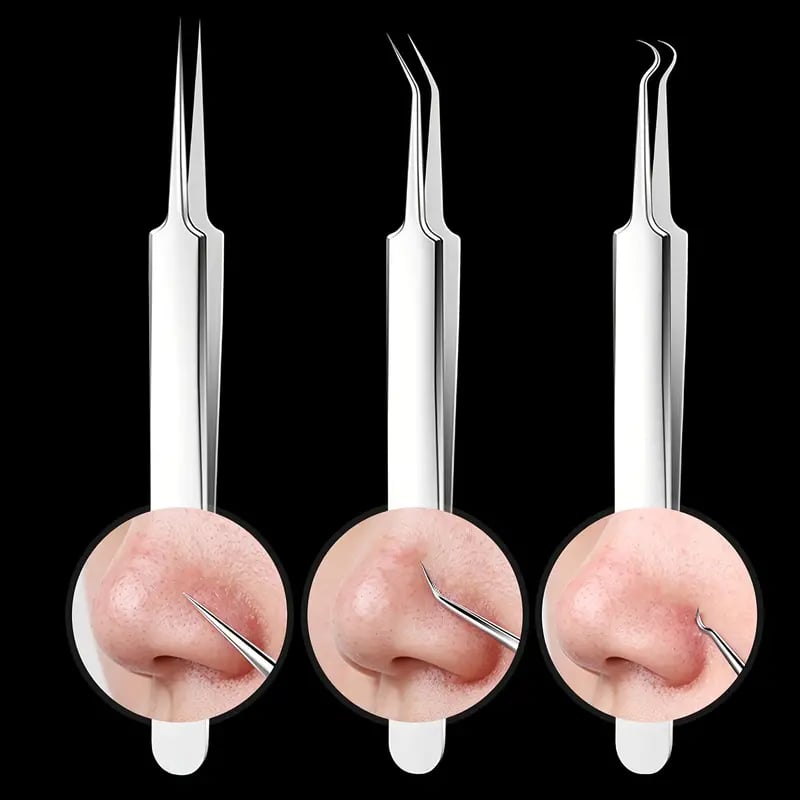 ClearPore™ – Mitesser-Pinzetten-Entferner-Set, präzise, effektiv, sicher & hygienisch [1 + 1 Gratis]