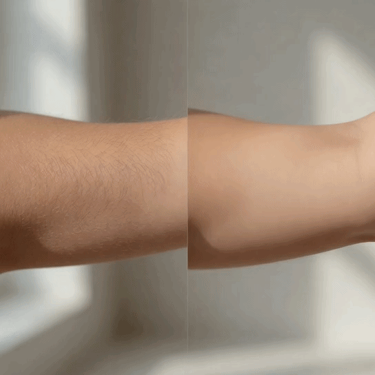 VelvetSkin™ Cyperus-Haarentfernungsöl für sanfte Pflege
