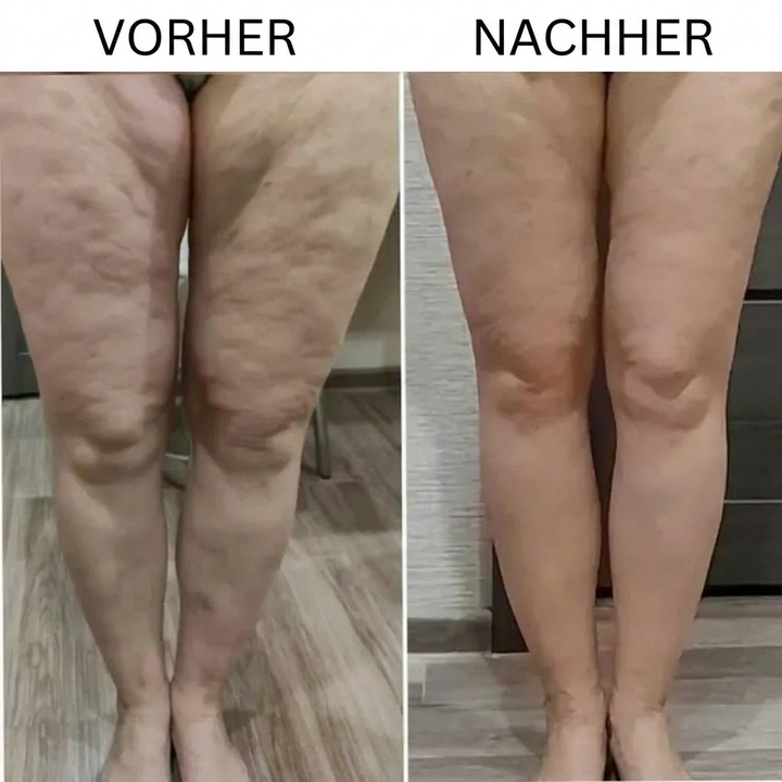 KonturLift™ 3-in-1 Körperformungsgerät