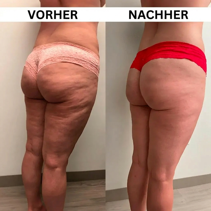 KonturLift™ 3-in-1 Körperformungsgerät