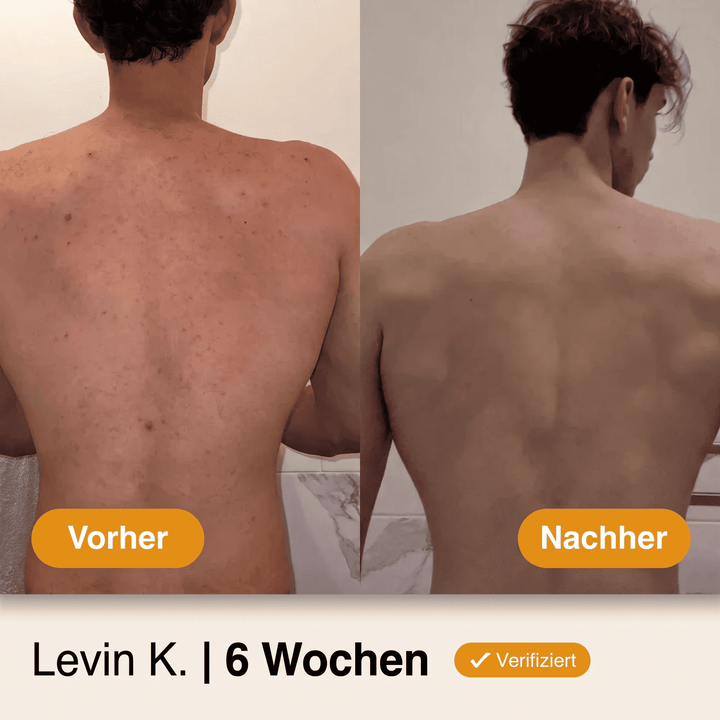 HautKlar™ Körperwaschgel gegen Unreinheiten