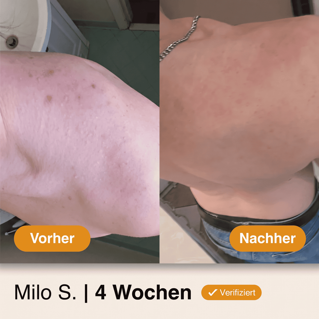 HautKlar™ Körperwaschgel gegen Unreinheiten