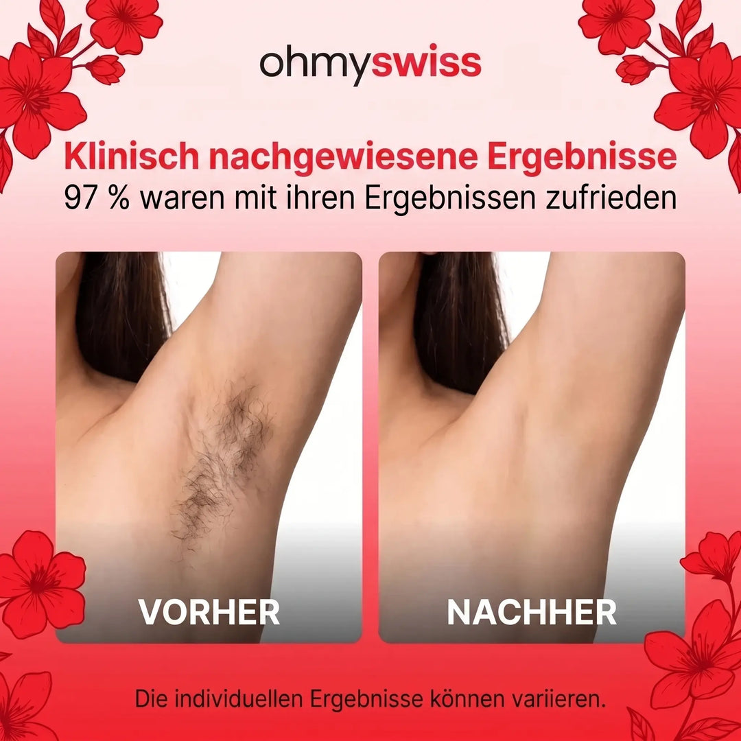 HaarSanft™ Erdmandelöl zur Haarwuchsreduktion