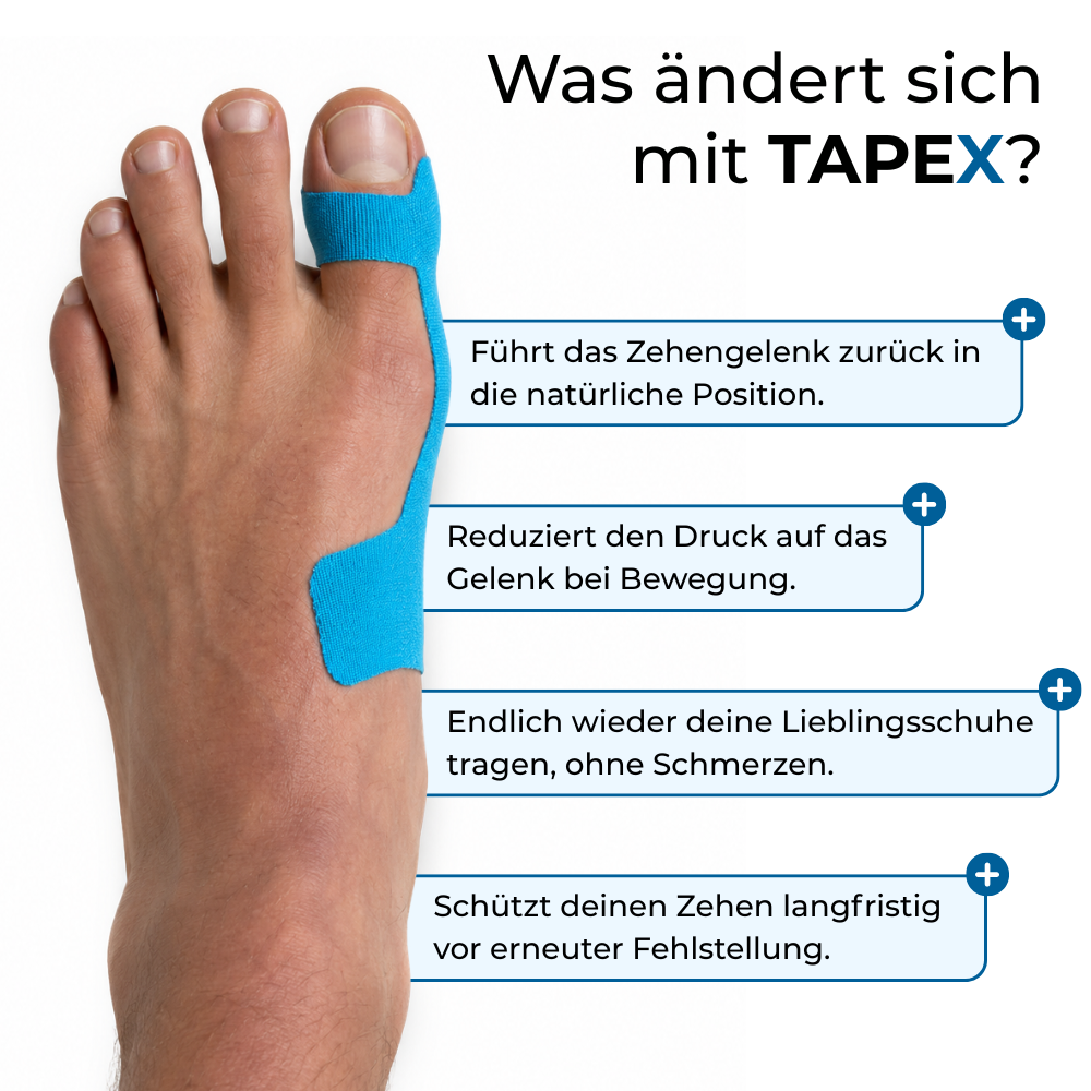 ZehenSanft™ Hallux-Valgus-Korrekturbandage