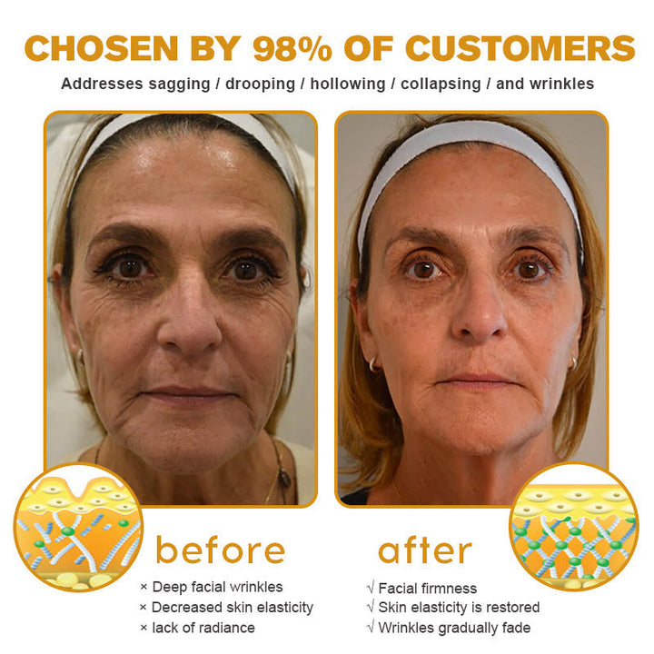 FirmTouch™ – Glättende Hautpflege, Faltenreduktion & intensive Feuchtigkeit [1 + 1 Gratis]