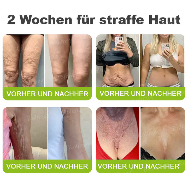 💫👨‍⚕️Jetzt jugendliche Haut zurückgewinnen 💫Rolimey® Botox & Vita-A Retinol Shot Falten-Lift Straffungscreme