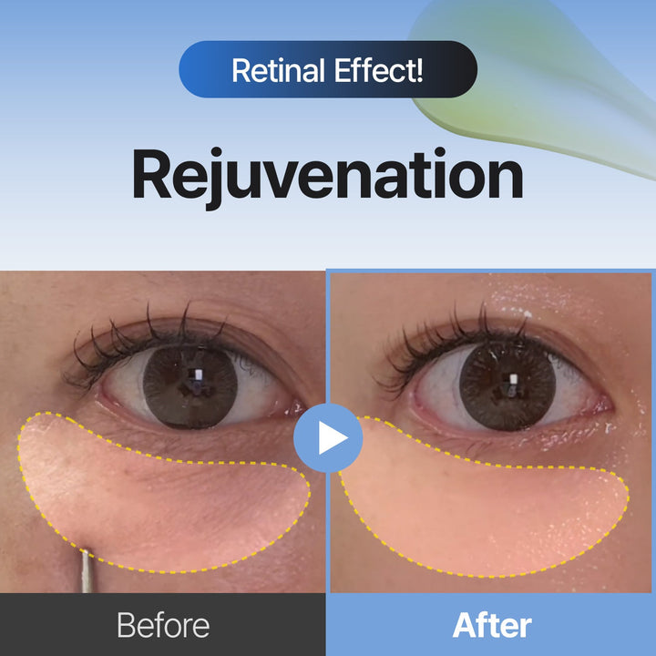 HautErneuer™ Retinal-Serum gegen Pigmentflecken & Falten