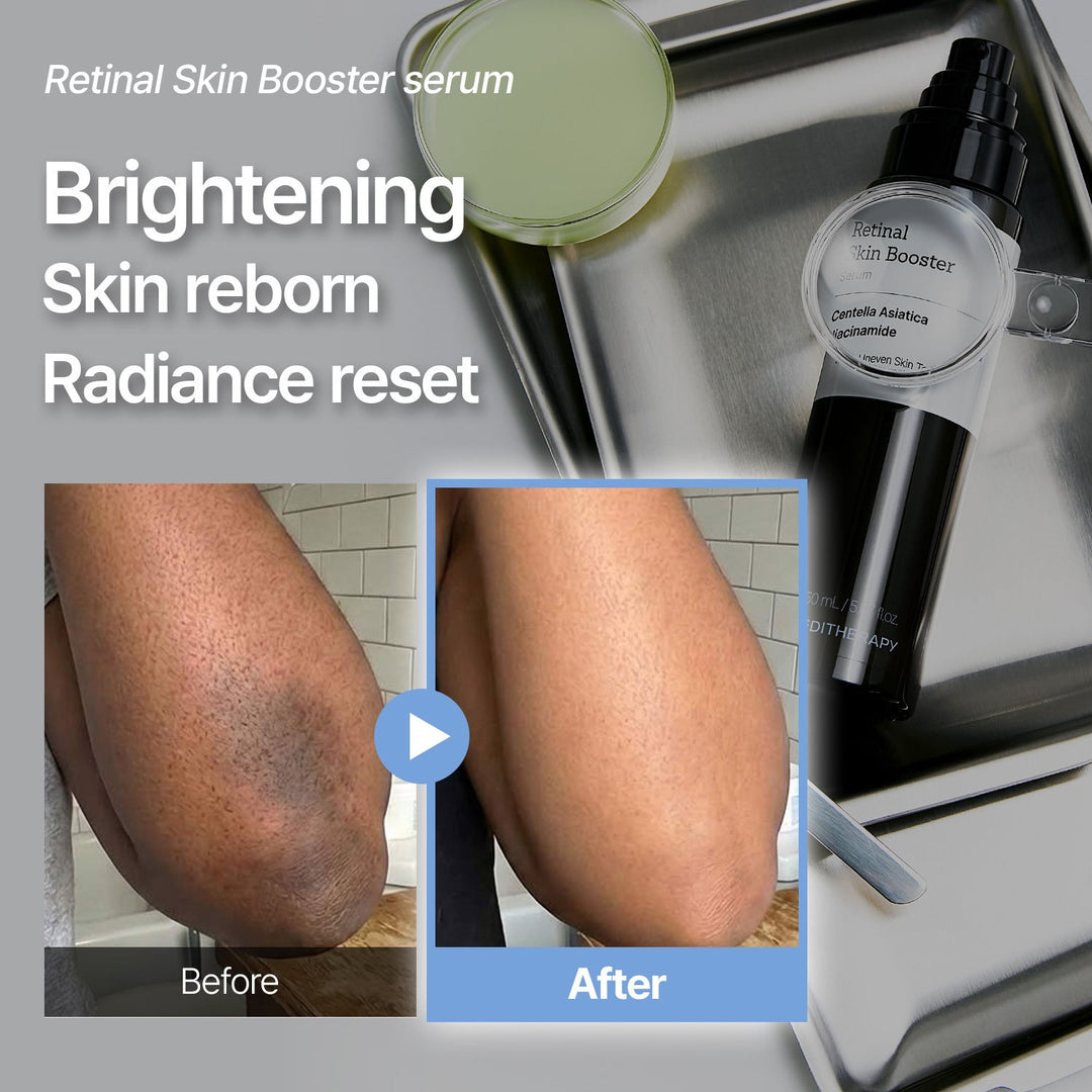 HautErneuer™ Retinal-Serum gegen Pigmentflecken & Falten