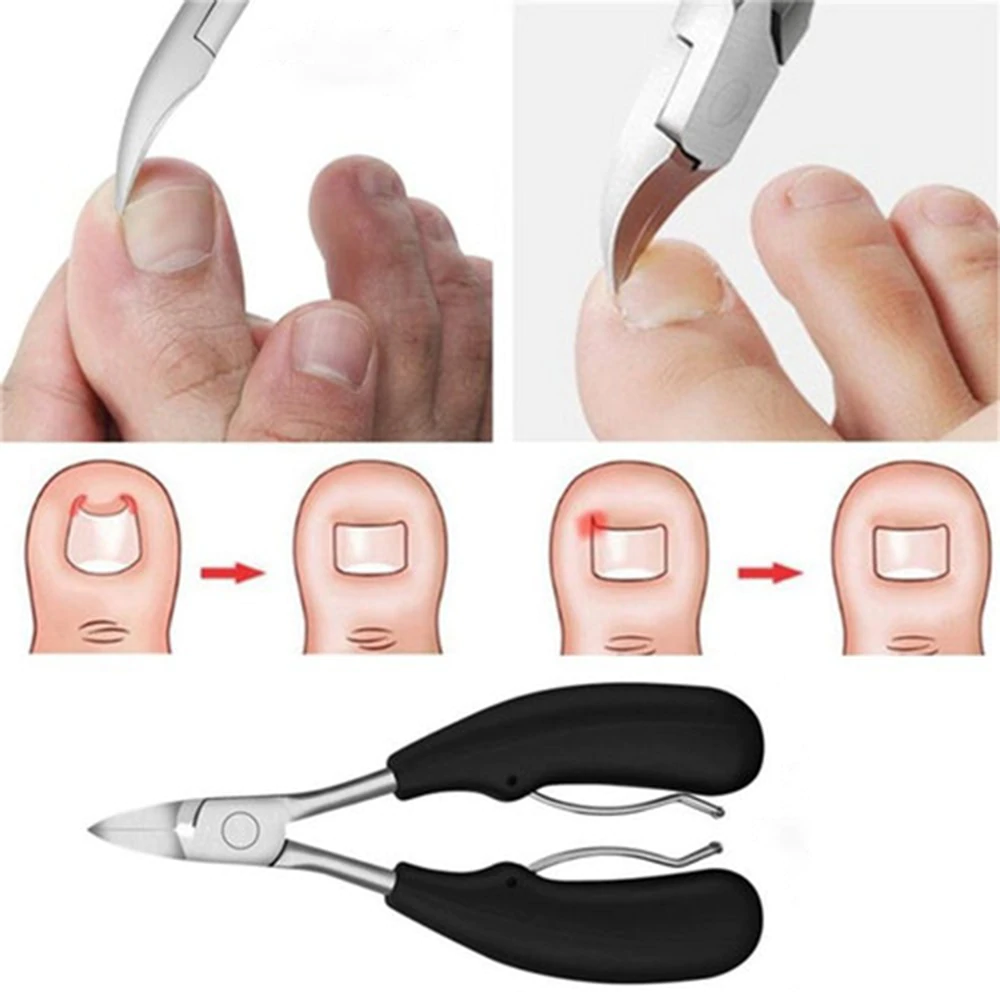 PädiSchere - Orthopädische Nagelschere