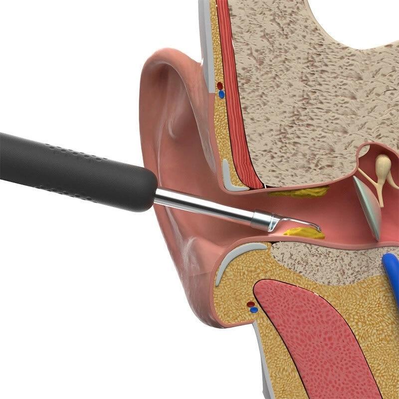 EarScope™ – Kabellose Endoskop-Ohrreiniger-Kamera für Präzise & Sichere Reinigung [50% Rabatt]