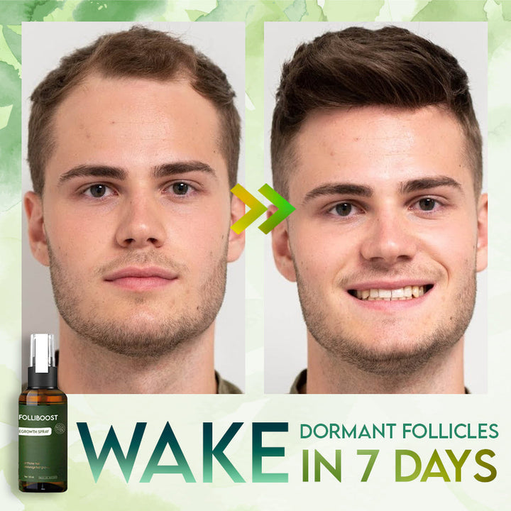 FolliBoost™ – Natürliche Lösung für dichteres, gesundes Haar!
