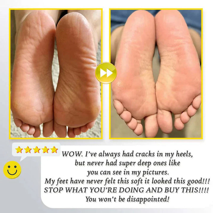 Gleam™ - Sanfte Hornhautentfernung für weiche, glatte Füße