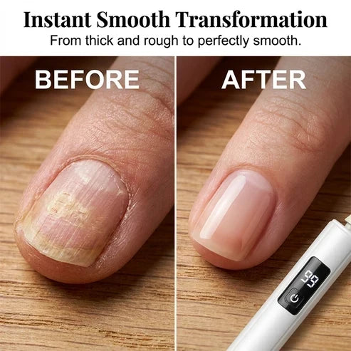 NagelPro™ Elektrisches Präzisions-Nagelpflegeset