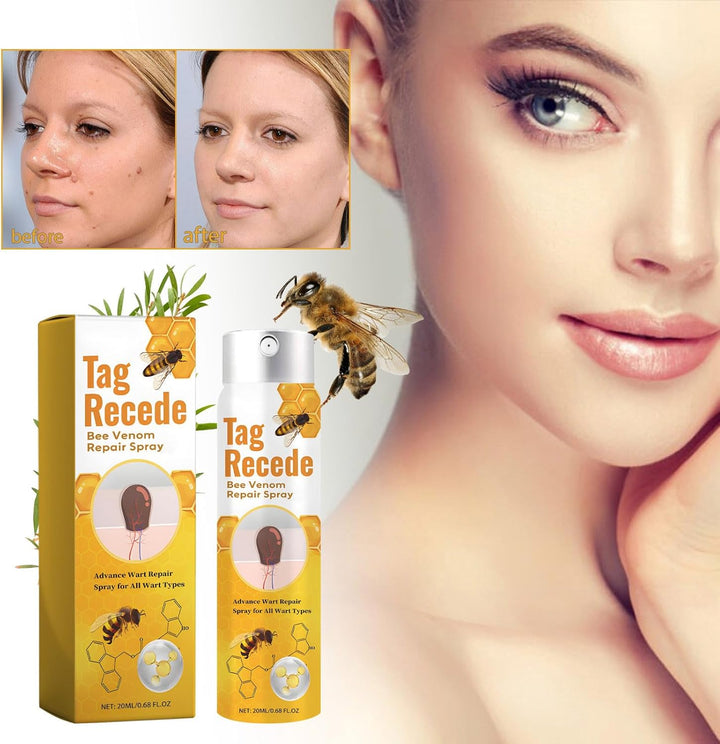 TagAway™ – Effektive Entfernung von Warzen und Hautwucherungen schnell und sicher [50% Rabatt]