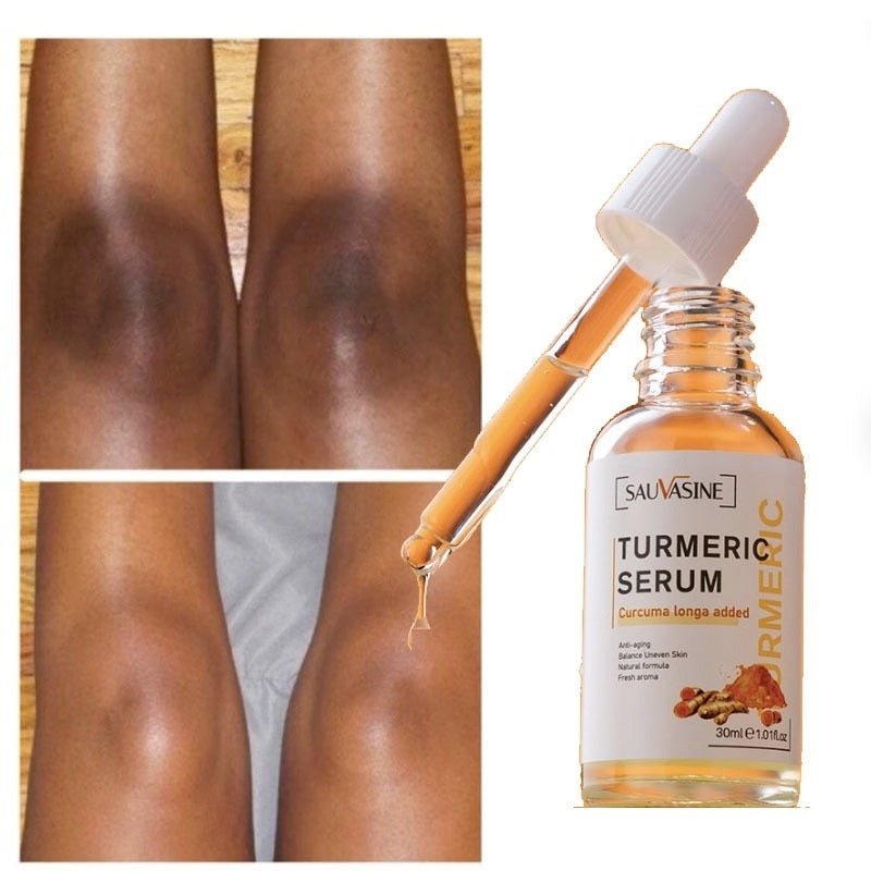 SpotClear™ – Strahlende Haut in nur wenigen schnellen Tagen [1 + 1 Gratis]