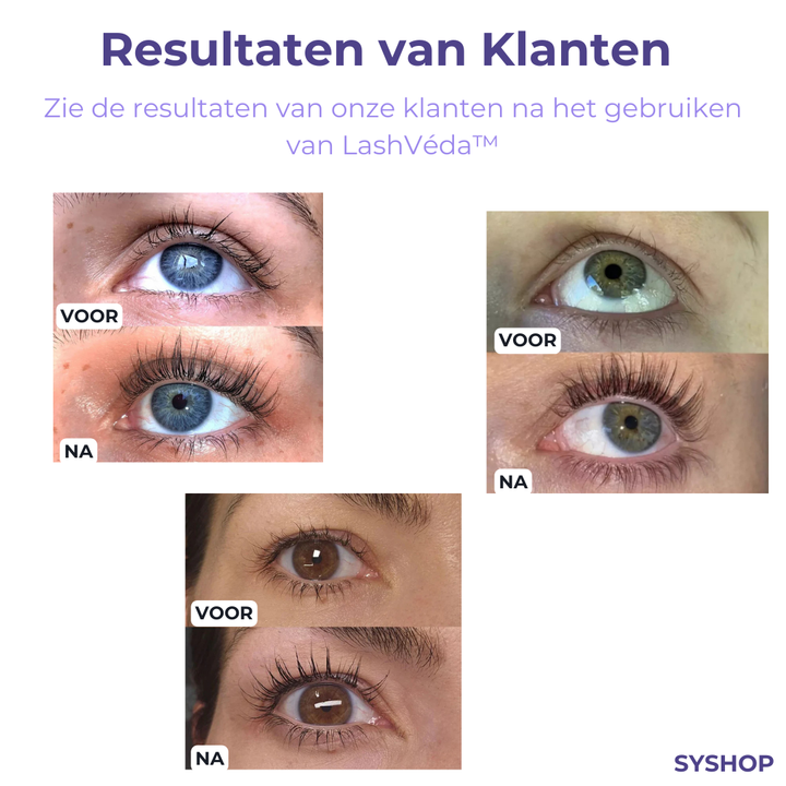LashVeda™ – Wimpernwachstums-Serum für längere, dichtere & gesunde Wimpern [1 + 1 Gratis]